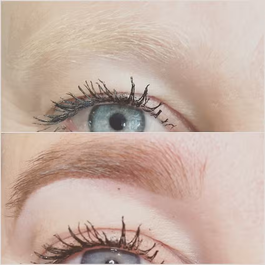 All Brows