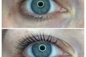 Beauty’s perfection