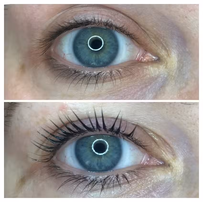 Beauty’s perfection