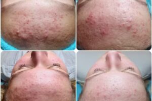 Beautysalon Op ’t Eerste Gezicht