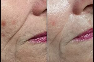 Beyna Skincare & Beauty