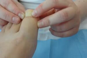 CHYLA Hand- en Voetverzorging