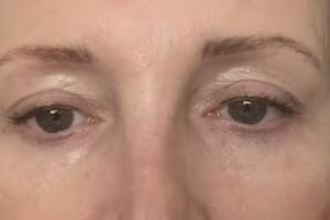 Huidinstituut Versailles