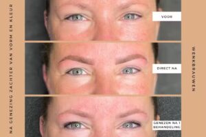 Marissa Gelden Permanente Make-up Huidverbetering