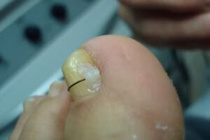 Pedicure happy Treat