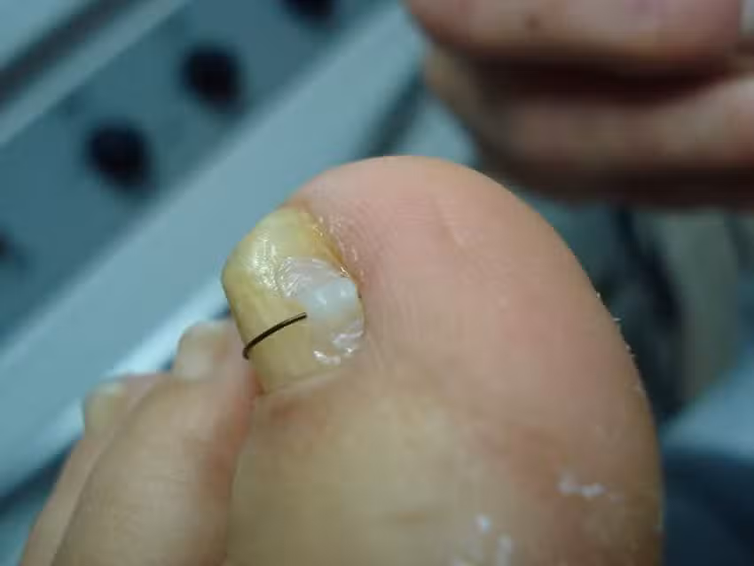 Pedicure happy Treat