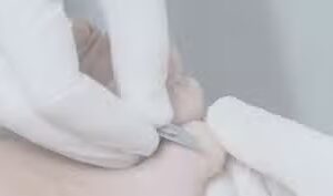 Pedicurepraktijk LooptGoed