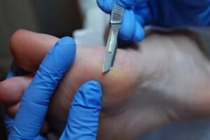 Pedikuur For You – Beek en Donk