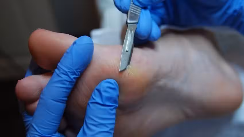 Pedikuur For You – Beek en Donk