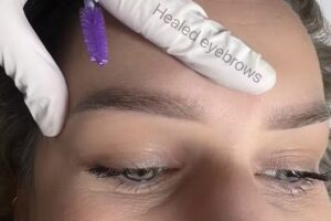 RedTouch Pro & Motus Deka Ontharingslaser