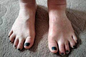 Salon Cura Medisch pedicure en Schoonheidsspecialiste