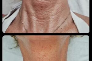 Schoonheidssalon Apeldoorn | Pedicure | Beautysalon Belissima