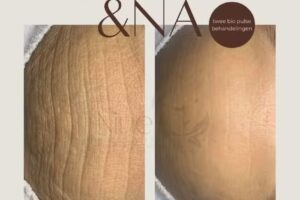 Schoonheidssalon – Nine huidcoach Elburg