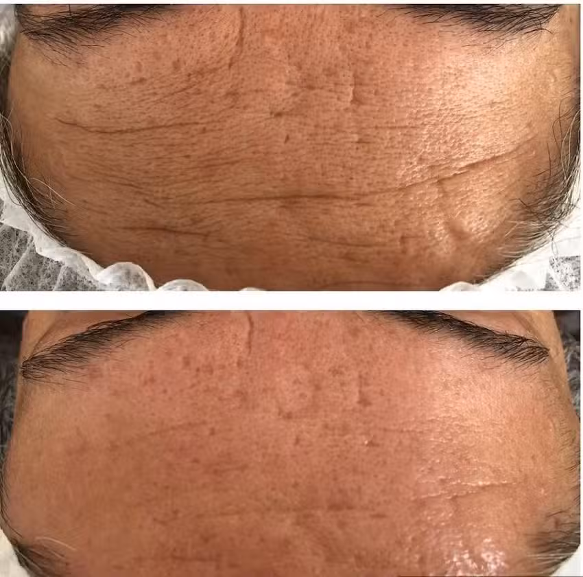 Skin Activity