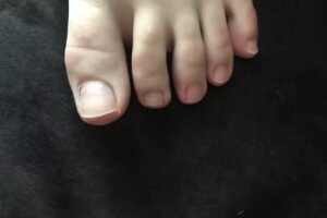 tiptoe – specialist in schimmelnagels en kalknagels – Capelle aan den IJssel