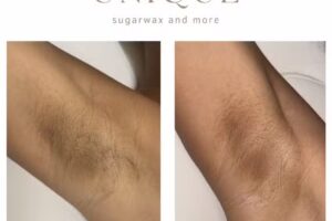 Unique sugaring