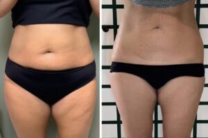 VIP Huidkliniek Breda