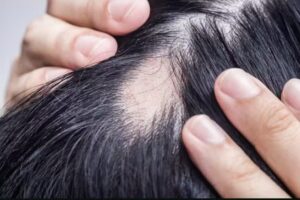 Vivre – Roosendaal